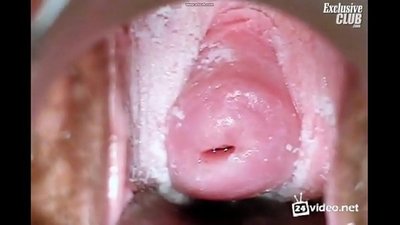 Người phụ nữ xinh đẹp khám phụ khoa